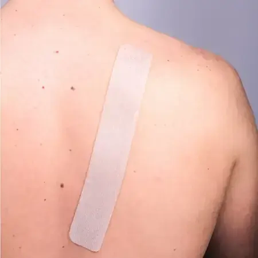 Пластырь от шрамов Resolve Skin SPF50+, 25 x 4 см, 1 штука, Pietrasanta Pharma: цены и характеристики