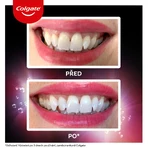 Colgate Max White Ultra Fresh Pearls, відбілююча зубна паста 50 мл: ціни та характеристики