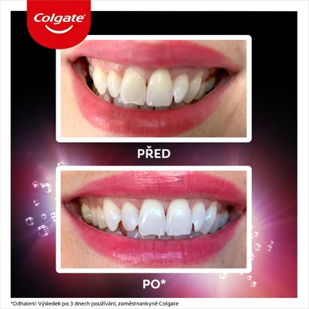 Colgate Max White Ultra Fresh Pearls, відбілююча зубна паста 50 мл: ціни та характеристики