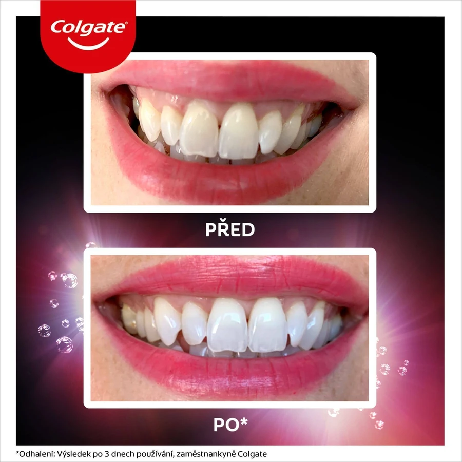 Colgate Max White Ultra Fresh Pearls, відбілююча зубна паста 50 мл: ціни та характеристики