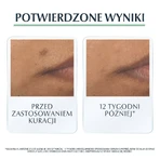 Eucerin DermoPure, захисний крем-флюїд для шкіри з недосконалостями та акне, SPF 30, 50 мл: ціни та характеристики