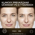 L'Oréal Paris Age Perfect Skin Serum 30 мл: цены и характеристики