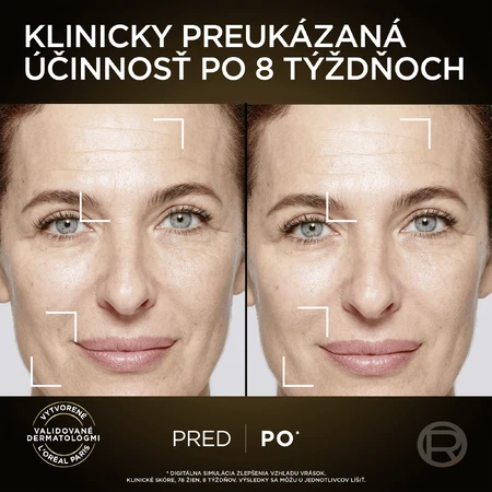 L'Oréal Paris Age Perfect Skin Serum 30 мл: цены и характеристики