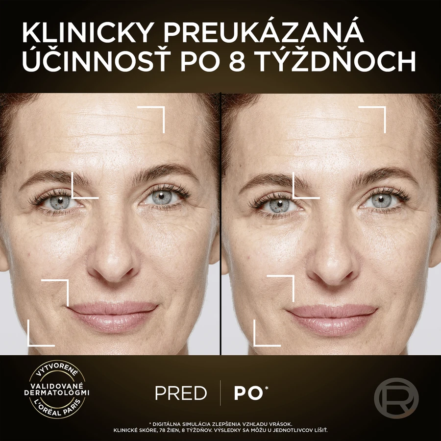 L'Oréal Paris Age Perfect Skin Serum 30 мл: цены и характеристики