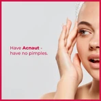 Крем для обличчя Biotrade Acne Out Hydro Active Cream зволожувальний, заспокійливий, 60 мл: ціни та характеристики