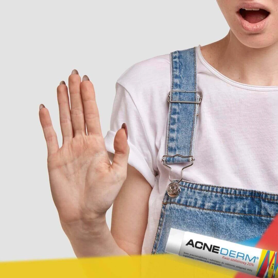 Acne-Derm крем проти акне, азелаїнова кислота 20% 20 г: ціни та характеристики