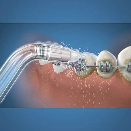 Ортодонтичні головки для ротової насадки, 2 загубники, OD-100, Waterpik: ціни та характеристики