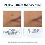 Eucerin DermoPure, сыворотка тройного действия для кожи с несовершенствами и угревой сыпью, 40 мл: цены и характеристики
