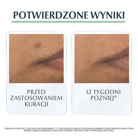 Eucerin DermoPure, сыворотка тройного действия для кожи с несовершенствами и угревой сыпью, 40 мл: цены и характеристики