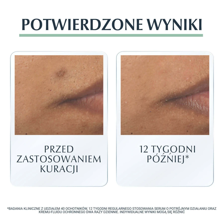 Eucerin DermoPure, сыворотка тройного действия для кожи с несовершенствами и угревой сыпью, 40 мл: цены и характеристики