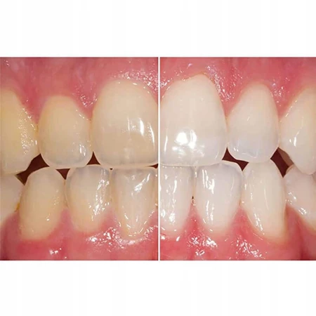 Отбеливающая зубная паста Opalescence Cool Mint, 133 г, Ultradent: цены и характеристики