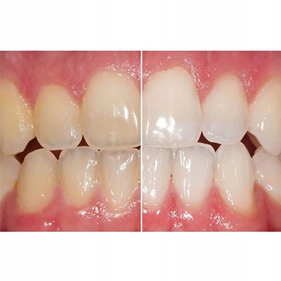 Отбеливающая зубная паста Opalescence Cool Mint, 133 г, Ultradent: цены и характеристики