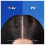 Head & Shoulders Anti-Hair Fall Кофеин против перхоти ампулы 400 мл: цены и характеристики