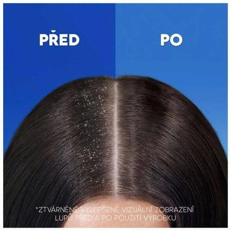 Head & Shoulders Anti-Hair Fall Кофеин против перхоти ампулы 400 мл: цены и характеристики