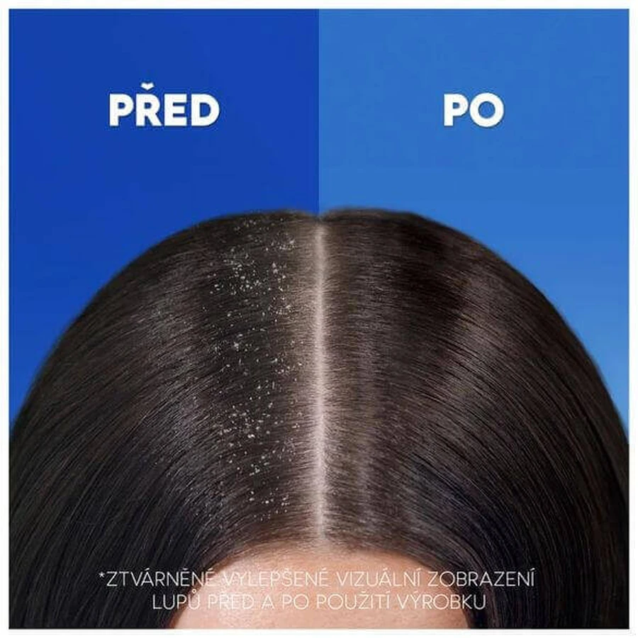 Head & Shoulders Anti-Hair Fall Кофеин против перхоти ампулы 400 мл: цены и характеристики