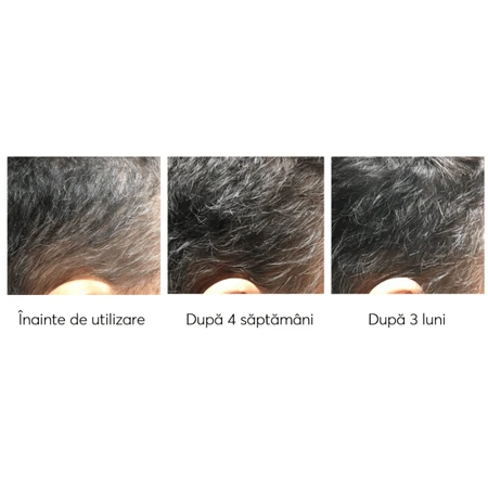 Набор против выпадения волос, Ageless Clinic, 3 штуки, Ru:t hair, 80 мл, Biocart: цены и характеристики