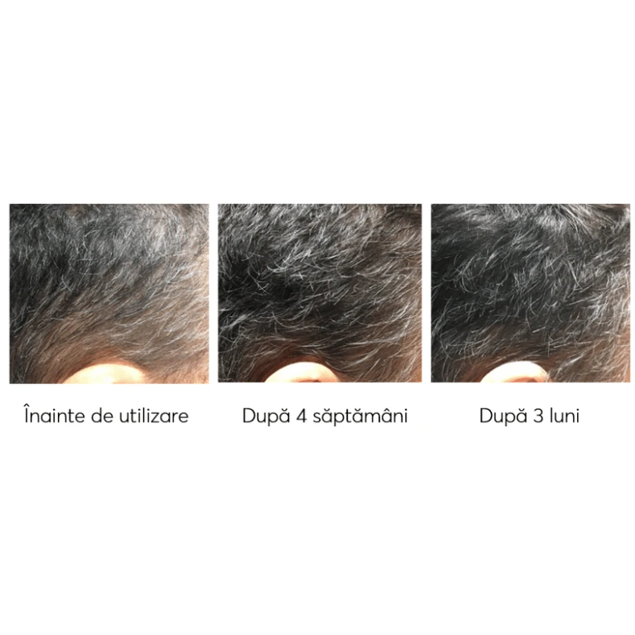 Набор против выпадения волос, Ageless Clinic, 3 штуки, Ru:t hair, 80 мл, Biocart: цены и характеристики