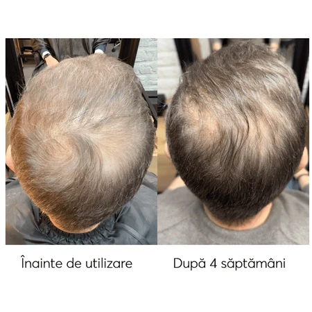 Набор против выпадения волос, Ageless Clinic, 3 штуки, Ru:t hair, 80 мл, Biocart: цены и характеристики