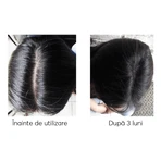 Набор против выпадения волос, Ageless Clinic, 3 штуки, Ru:t hair, 80 мл, Biocart: цены и характеристики