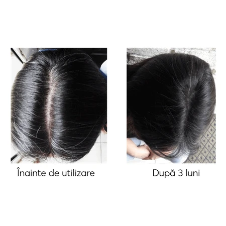 Набор против выпадения волос, Ageless Clinic, 3 штуки, Ru:t hair, 80 мл, Biocart: цены и характеристики
