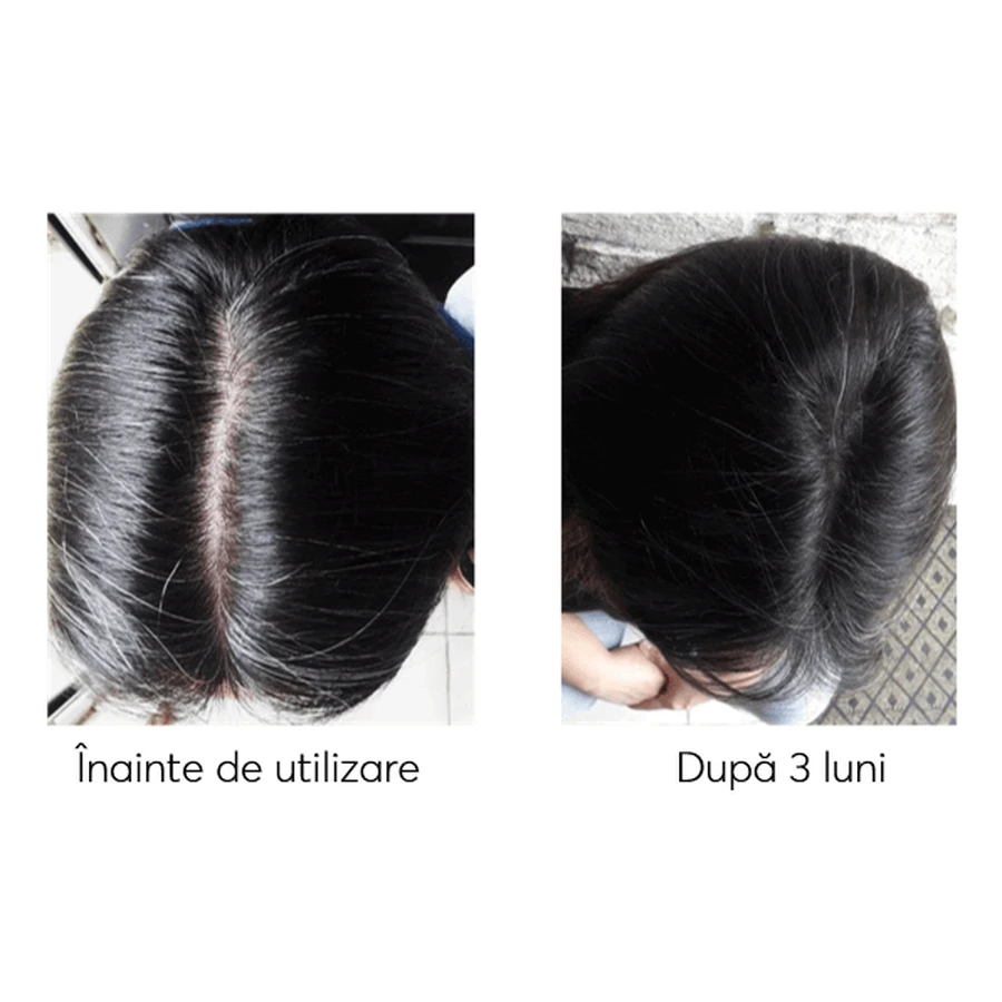 Набор против выпадения волос, Ageless Clinic, 3 штуки, Ru:t hair, 80 мл, Biocart: цены и характеристики