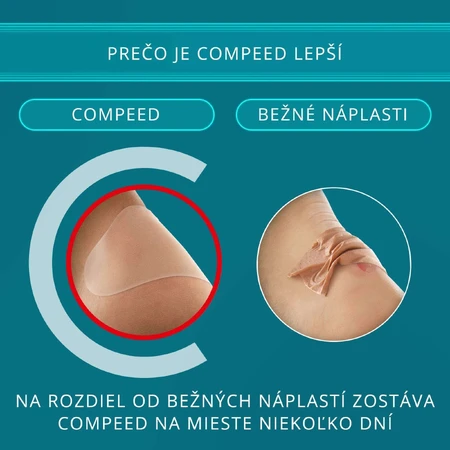 Пластырь Compeed Puzgie малый 6 шт: цены и характеристики