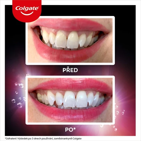 Colgate Max White Ultra Multiprotect отбеливающая зубная паста 50 мл: цены и характеристики