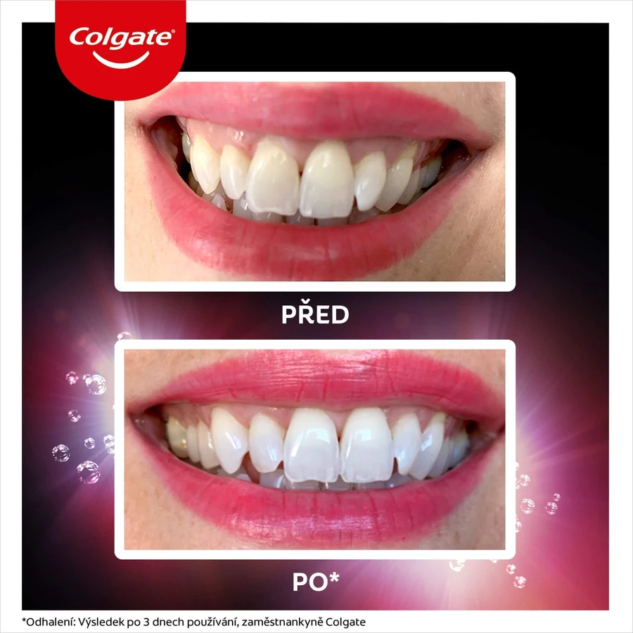 Colgate Max White Ultra Multiprotect отбеливающая зубная паста 50 мл: цены и характеристики