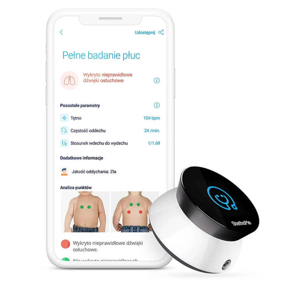 StethoMe, інтелектуальний стетоскоп для всієї родини: ціни та характеристики