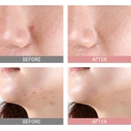 Mizon Good Bye Blemish Pink Spot, Сироватка-пудра проти прищів 19 мл: ціни та характеристики
