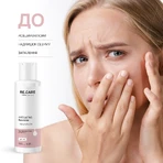 Тонер для лица Re.Care Exfoliating Face Toner отшелушивающий 150 мл: цены и характеристики