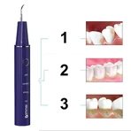 Oromed Oro-Scal Dent, ультразвуковий зубний скалер: ціни та характеристики