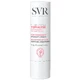 SVR