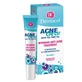Dermacol Acneclear Точечный уход против акне для кожи, склонной к акне, 15 мл
