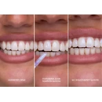 Блиск для зубів SmileKit Glostik, 4 мл: ціни та характеристики