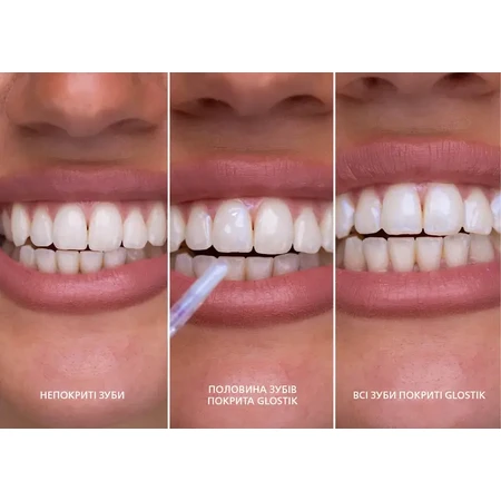 Блиск для зубів SmileKit Glostik, 4 мл: ціни та характеристики