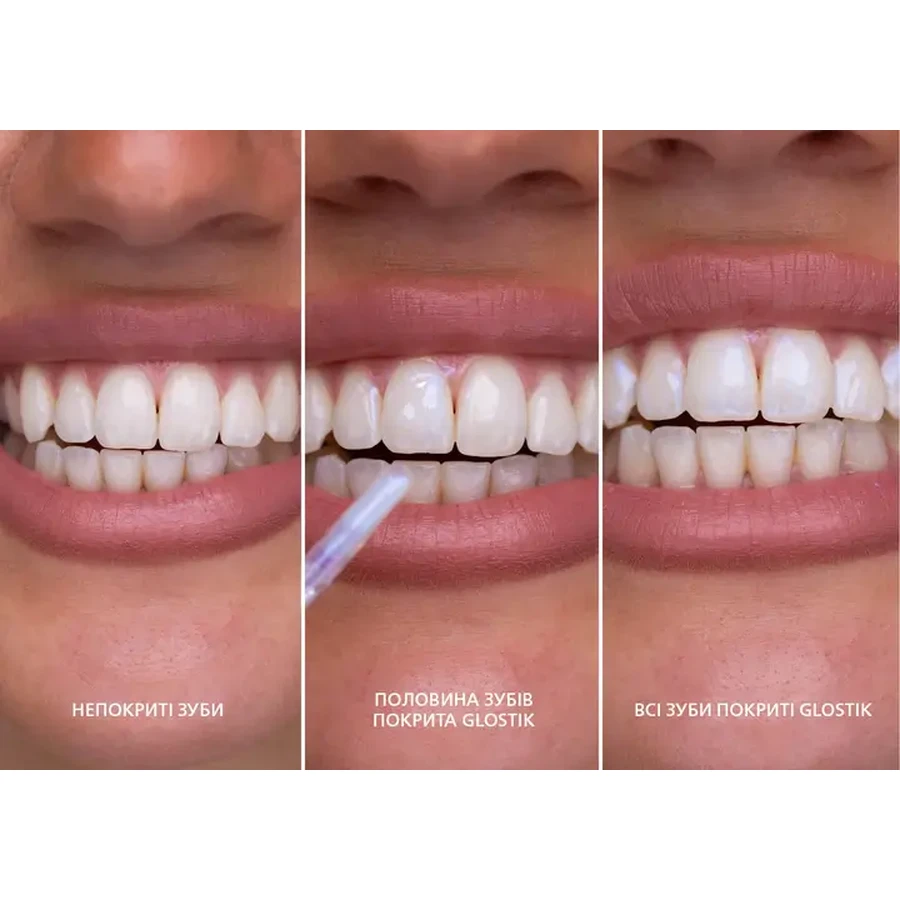 Блиск для зубів SmileKit Glostik, 4 мл: ціни та характеристики