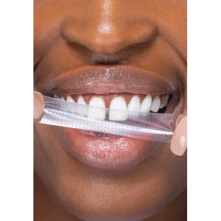 Полоски для зубов SmileKit PAP+ отбеливающие, 28 штук: цены и характеристики