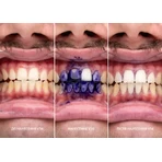 Корректор SmileKit для цвета зубов V34 30 мл: цены и характеристики