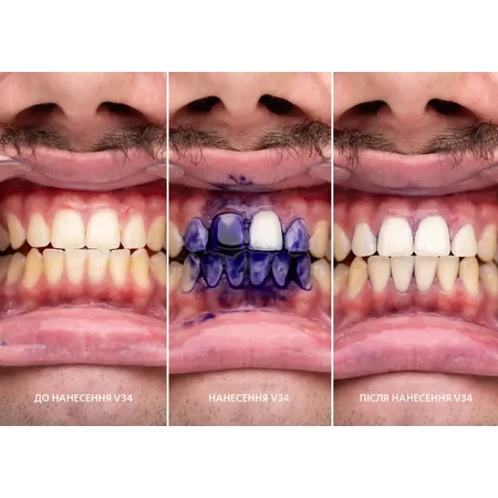 Корректор SmileKit для цвета зубов V34 30 мл: цены и характеристики