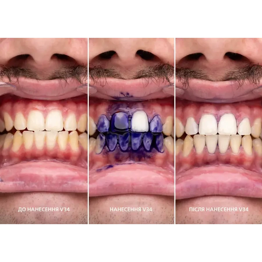 Корректор SmileKit для цвета зубов V34 30 мл: цены и характеристики