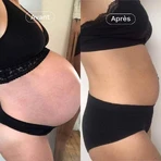 Omum Duo In&Out Stretch Marks I equipped: цены и характеристики