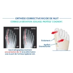 Ортез Epitact для ночной коррекции hallux valgus x1: цены и характеристики