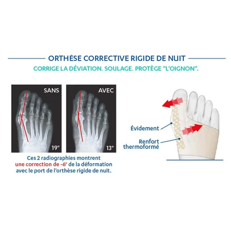 Ортез Epitact для ночной коррекции hallux valgus x1: цены и характеристики