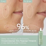 Caudalie Vinopure, gel de curățare pentru curățarea feței, piele predispusă la acnee, 385 ml: цены и характеристики