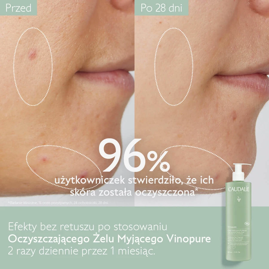 Caudalie Vinopure, gel de curățare pentru curățarea feței, piele predispusă la acnee, 385 ml: цены и характеристики