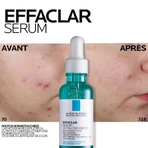 La Roche-Posay Effaclar Сироватка для обличчя проти недосконалостей шкіри, схильної до акне, 30 мл: ціни та характеристики