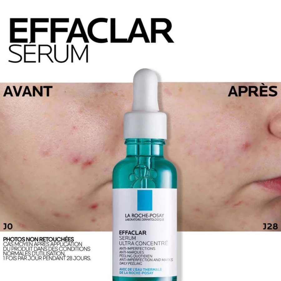 La Roche-Posay Effaclar Сироватка для обличчя проти недосконалостей шкіри, схильної до акне, 30 мл: ціни та характеристики