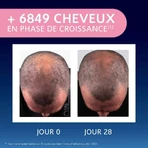 Arkopharma Forcapil Эликсир для роста Cheveux Clairsemés 50 мл: цены и характеристики