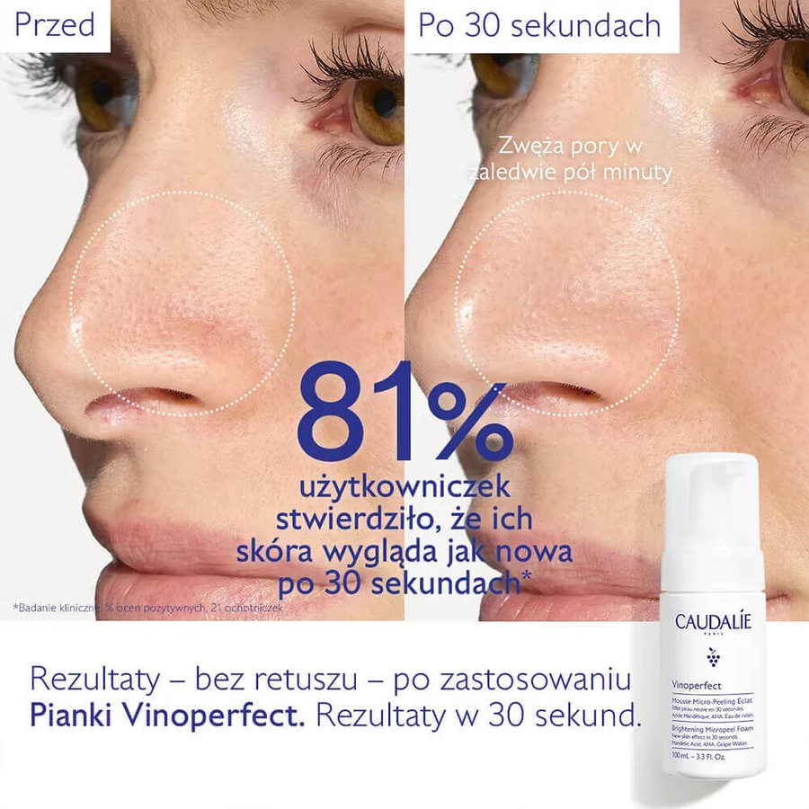 Caudalie Vinoperfect, осветляющая микропилинг-пенка, 50 мл: цены и характеристики